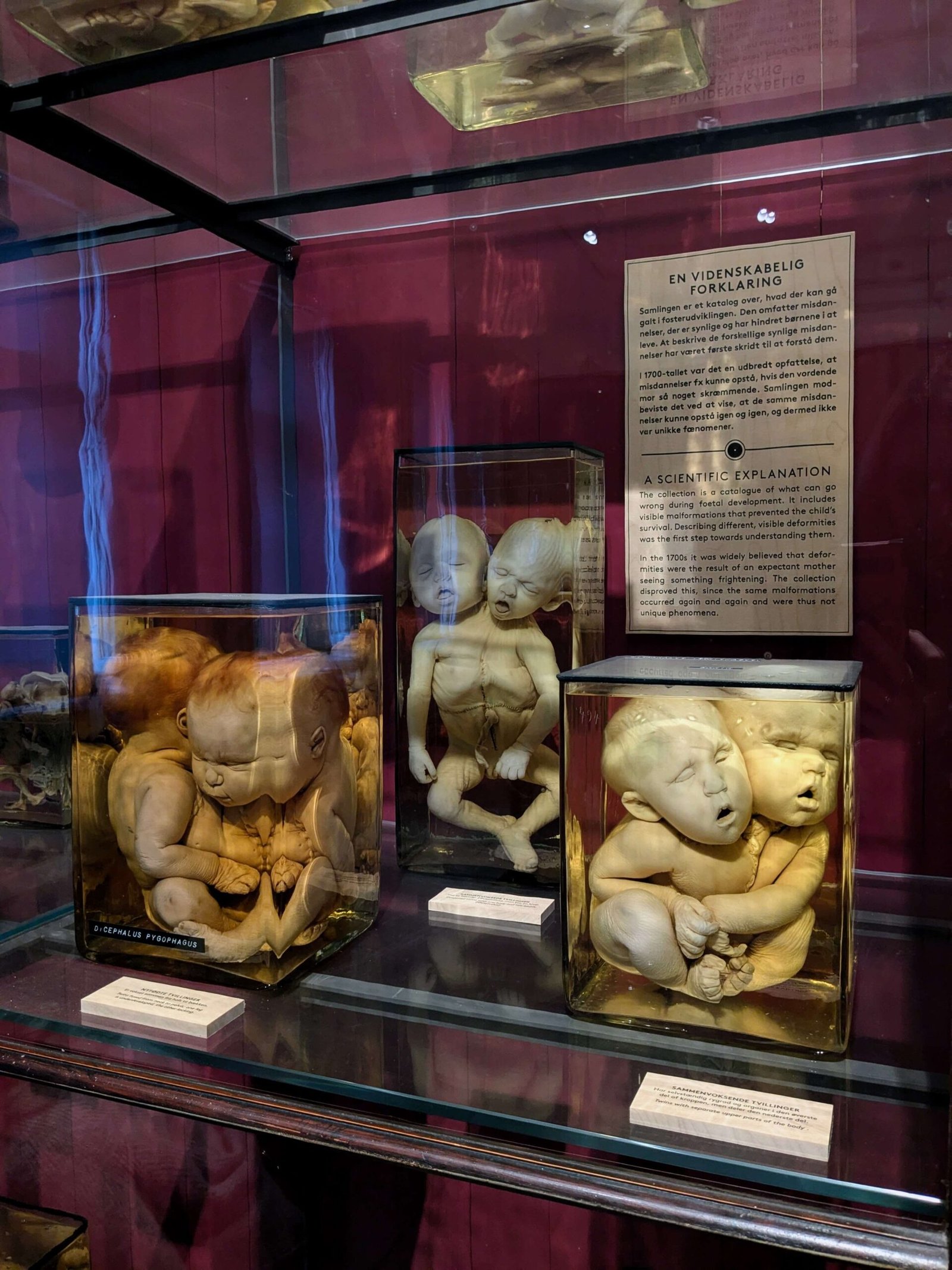 specimen at the  Medicinsk Museion in Copenhagen